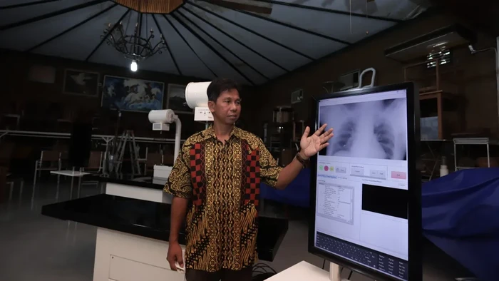 UGM Hadirkan Skrining Tuberkulosis Keliling dengan Dukungan AI