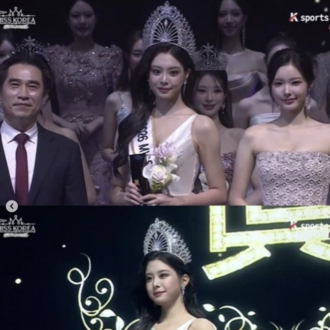 10 Potret Dulu vs Sekarang Woo Seo Yoon, Miss Korea 2026 Dituding Oplas