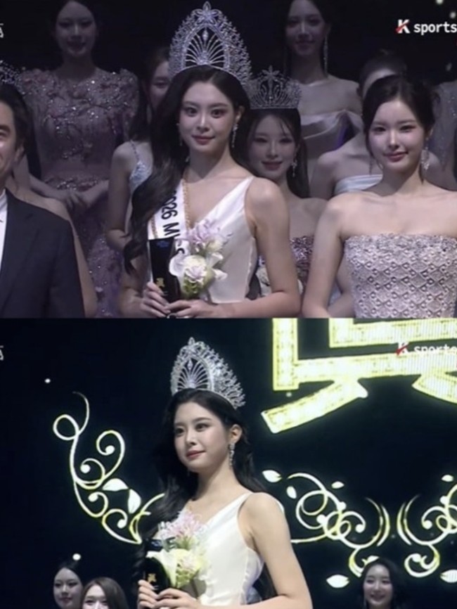10 Potret Dulu vs Sekarang Woo Seo Yoon, Miss Korea 2026 Dituding Oplas