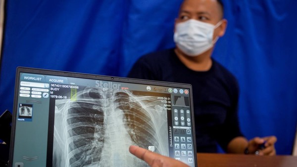 82 Juta Warga Sudah Ikuti Cek Kesehatan Gratis, Penyakit Ini Banyak Ditemukan