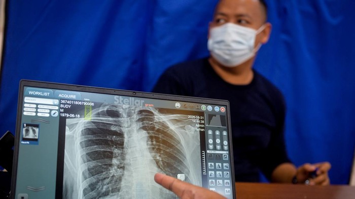 Petugas kesehatan menunjukkan hasil rontgen toraks seorang warga saat pelaksanaan Cek Kesehatan Gratis di Pondok Aren, Kota Tangerang Selatan, Banten, Senin (31/8/2026). Kementerian Kesehatan mencatat pelaksanaan program Cek Kesehatan Gratis telah me