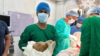 Batu Kandung Kemih Raksasa Seberat 3,1 Kg Diangkat dari Tubuh Pasien Umur 52