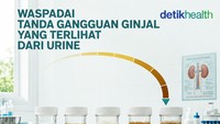 Infografis: Waspadai Tanda Ginjal Rusak, Bisa Terlihat dari Perubahan Urine