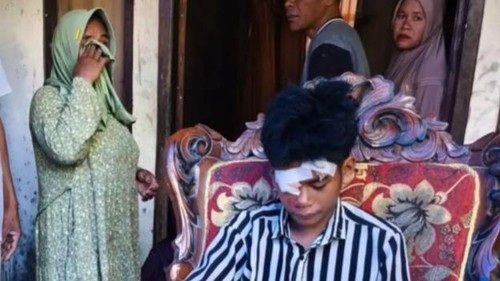 Korban selamat longsor tambang emas di Sumbawa, Minggu (6/9/2026).