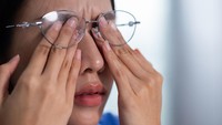 Abu Vulkanik Masuk Mata? Jangan Dikucek, Ini Anjuran Dokter