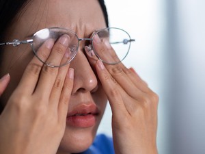 Abu Vulkanik Masuk Mata? Jangan Dikucek, Ini Anjuran Dokter