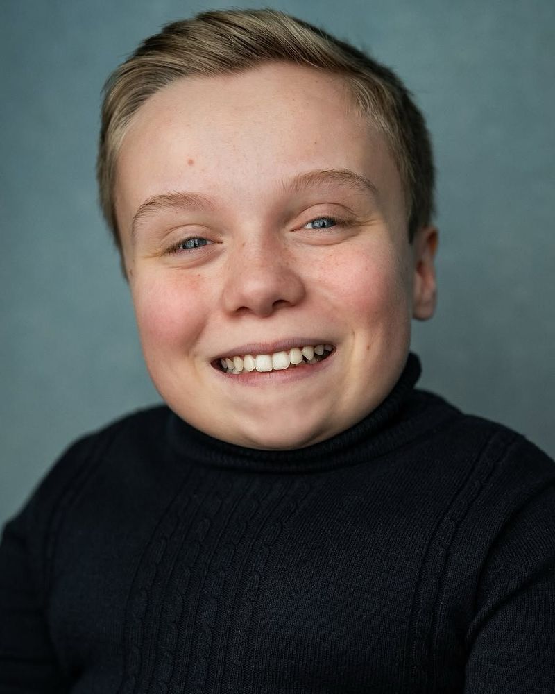 Pemeran Serial Harry Potter Lenny Anthony Rush memerankan Dobby.