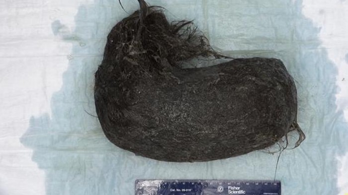 Gumpalan rambut
