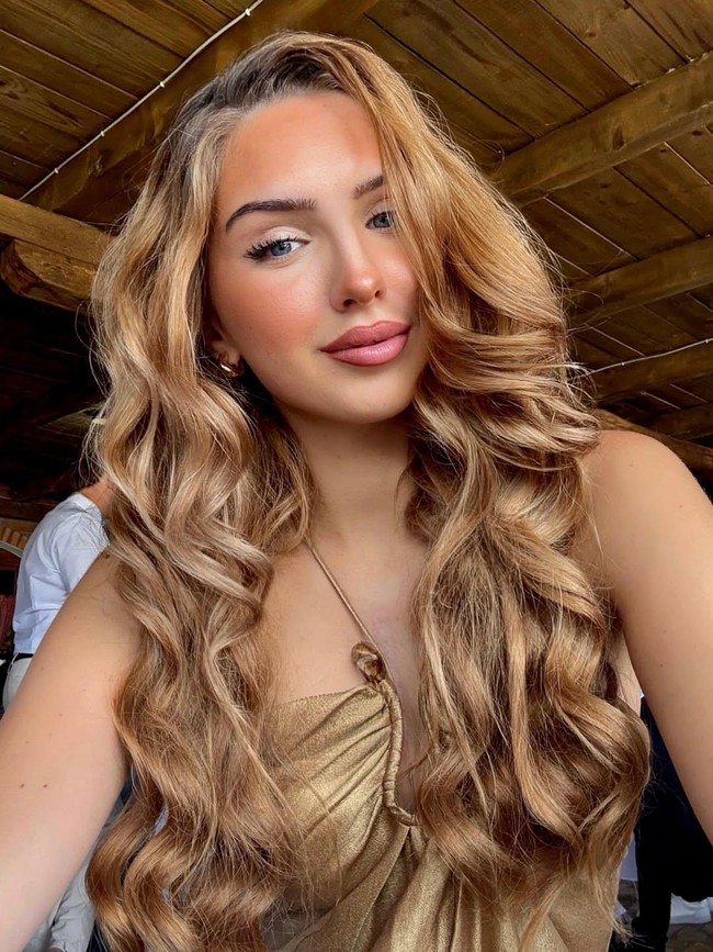 Foto Miss Austria yang Meninggal di Usia 22, Punya Riwayat Penyakit Jantung