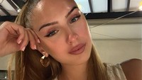 Miss Austria Meninggal di Usia 22 Tahun Saat Masih Menjabat