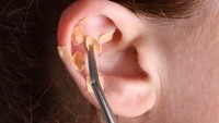 Viral Tren Atasi Stres dengan Ear Seeds, Banyak Digemari Idol K-Pop