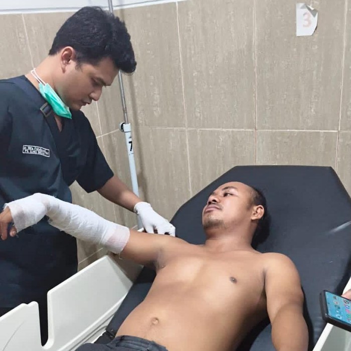 Relawan dirawat di RSUD AWS Samarinda usai alami luka bakar saat mememadamkan lahan terbakar. (dok Istimewa)