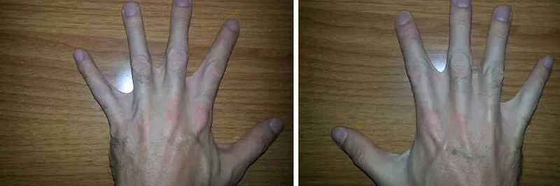 Deretan potret keunikan tubuh manusia