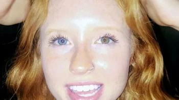 Rambut merah dan warna mata berbeda. Perempuan ini memiliki rambut merah alami sekaligus heterochromia, kondisi ketika warna kedua matanya berbeda. Kombinasinya membuat penampilannya semakin unik. Foto: via Boredpanda