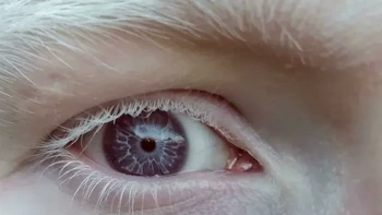 Mata berwarna ungu. Pemilik foto membagikan keunikan warna matanya yang tampak bernuansa ungu. Potret jarak dekat membuat warna iris yang tidak biasa itu terlihat semakin jelas. Foto: via Boredpanda