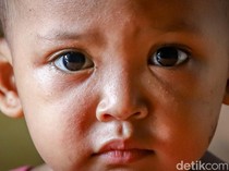 Warga Cilincing Keluhkan Debu Parah dari Proyek Marunda