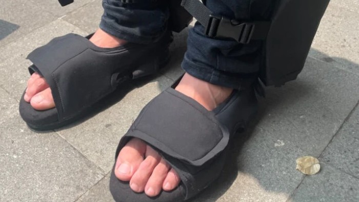 Glucowrap sandal pendeteksi komplikasi diabetes.