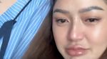 Siti Badriah Menangis Dampingi Krisjiana Vasektomi