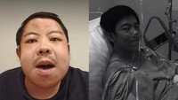 Viral Kisah Pria Jakbar Cuci Darah Sejak Usia 16 Tahun, Ternyata Ini Penyebabnya