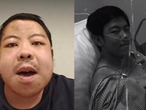 Viral Kisah Pria Jakbar Cuci Darah Sejak Usia 16 Tahun, Ternyata Ini Penyebabnya