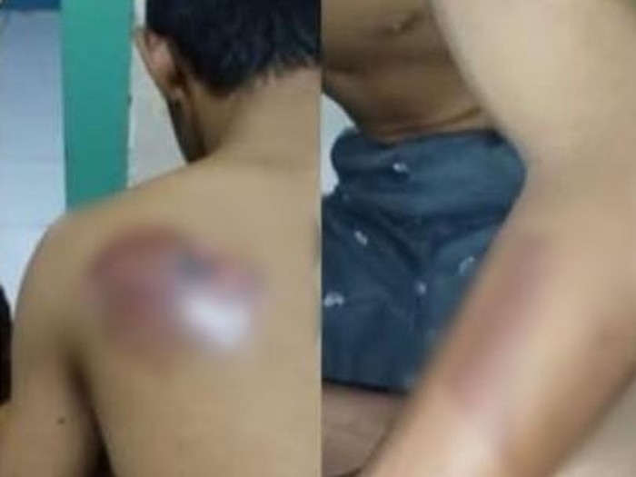 Santri difabel disterika senior