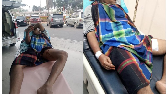 Korban serangan beruang hitam di Kotawaringin Barat mengalami luka-luka. (dok Istimewa)