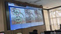 RSUD AWS Samarinda Jelaskan soal Kawat Tertinggal di Jantung Pasien