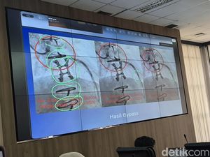 RSUD AWS Samarinda Jelaskan soal Kawat Tertinggal di Jantung Pasien