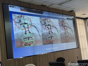 Kawat Tertinggal di Jantung, Dokter RSUD AWS Sengaja Demi Selamatkan Pasien?