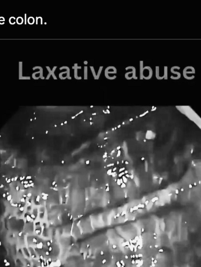 Laxative Abuse