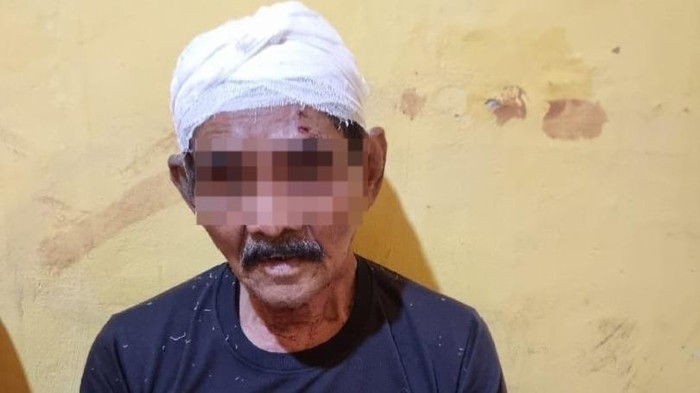 Tampang kakek yang babak belur dimassa di Mesuji