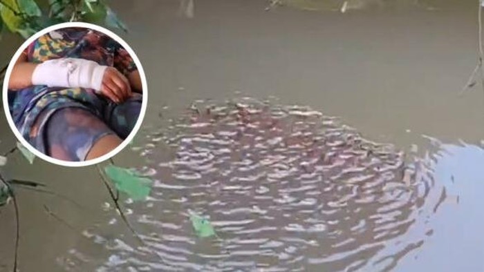 Bocah Diserang Ikan Gabus Raksasa