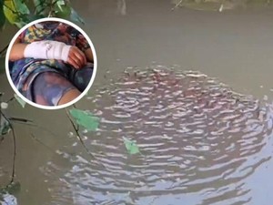 Bocah Diserang Ikan Gabus Raksasa, Tangannya Luka Parah
