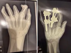 Foto-foto Medis Ini Bikin Merinding, Ada yang Sulit Dipercaya
