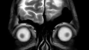 Siapa sangka hasil MRI kepala manusia bisa terlihat seperti wajah menyeramkan? Potongan gambar dari arah depan ini memperlihatkan otak dan kedua bola mata, menciptakan penampakan yang sekilas menyerupai karakter dalam film horor. Foto: Boredpanda