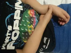 Foto-foto Medis Ini Bikin Merinding, Ada yang Sulit Dipercaya