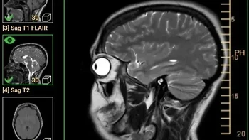 Hasil MRI kepala dari samping ini malah mengingatkan pemiliknya pada Homer Simpson. Bentuk mata yang menonjol dan profil wajah dalam pencitraan medis menciptakan penampakan unik yang sekilas menyerupai karakter kartun The Simpsons. Foto: Boredpanda