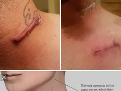 Foto-foto Medis Ini Bikin Merinding, Ada yang Sulit Dipercaya