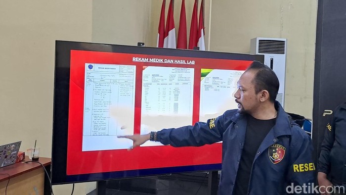 Kasat Reskrim Polresta Banda Aceh Kompol Miftahuda Dizha Fezuono memperlihatkan rekam medik dan hasil lab Muhammad Rasya. (Agus Setyadi/detikcom)