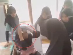 Siswi SMP di Sidrap Sulsel Di-bully 10 Temannya, Ortu Lapor Polisi
