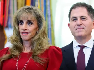 Heboh Disebut Alien, Intip Transformasi Wajah Susan Dell