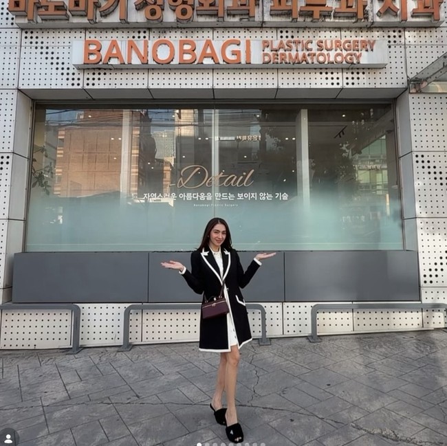 Potret Angel Karamoy Kembali Oplas di Korea Agar Wajah & Tubuh Makin Kencang