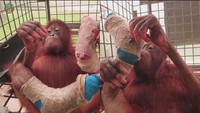 Bertahan di Atas Pohon Saat Dikepung Kebakaran Hutan, Novita Kini Kehilangan 4 Jari