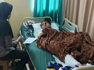 Sadis! Wanita di Lampung Dibakar Suami, Korban Alami Luka 80 Persen