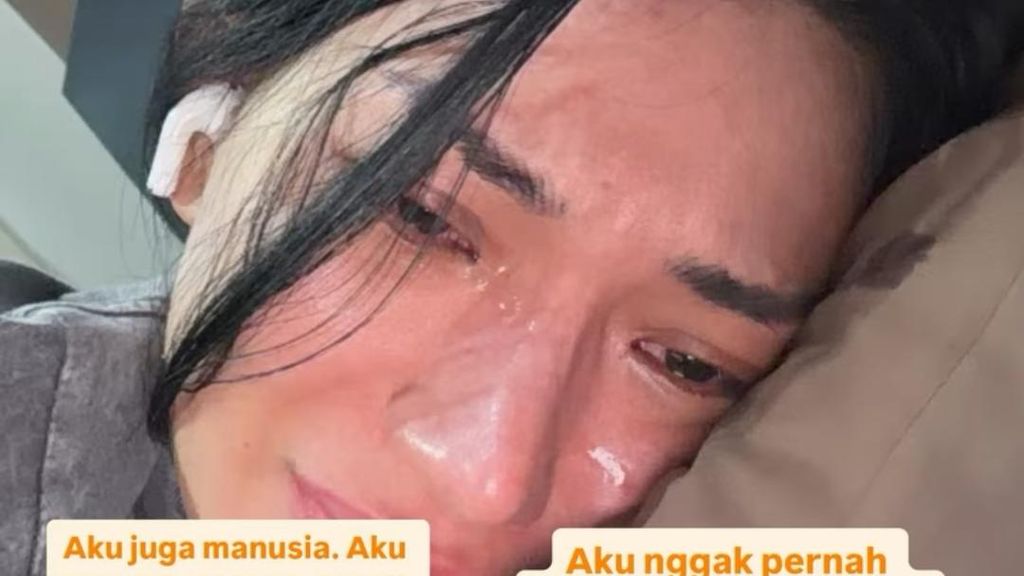 Trauma Usai Alami Dugaan Pelecehan, Berlliana Lovell Batalkan Pekerjaan