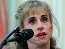 Heboh Disebut Alien, Intip Transformasi Wajah Susan Dell