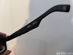 Melihat Isi Paket Asus ROG Xbox Ally X20 Bundle, Ada Kacamata AR