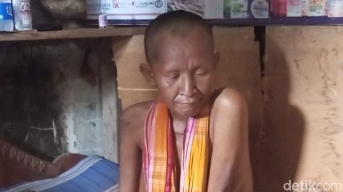 Pasien miskin yang dipulangkan Pihak Puskesmas Woha, Kabupaten Bima, NTB hanya karena tak punya KTP, Minggu (18/10/2026).