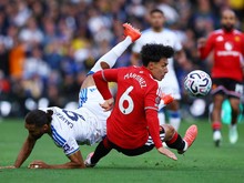 MU Gagal Menang Lagi, Lisandro Martinez Cedera