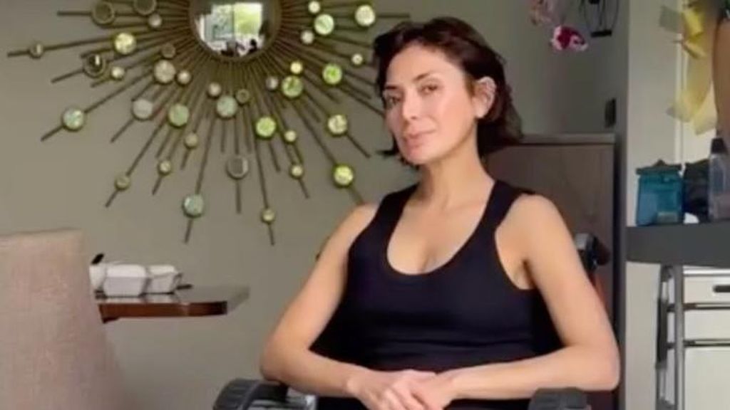 Aimee Juliette Kecelakaan Motor di Italia, 2 Bulan Berjuang Pulihkan Diri